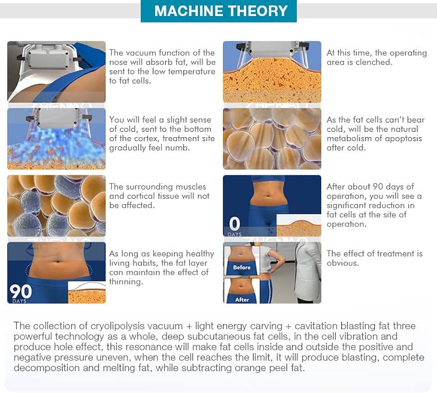 Amazon.co.jp: クリオリポリシスマシン 脂肪冷凍マシン 脂肪凍結